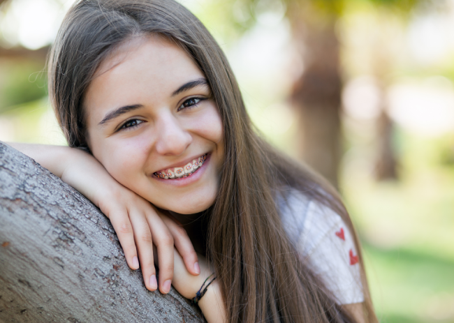 All You Need To Know About Braces Before You Get Them